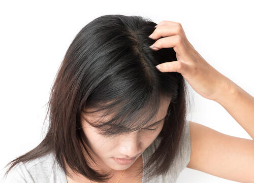 Get Rid of Itchy Scalp with These Simple Home Remedies | Vaya News