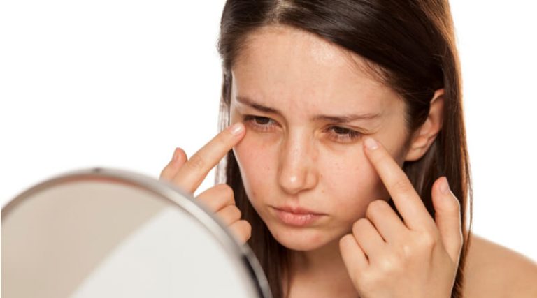 periorbital-dark-circles-here-s-how-to-deal-with-it-naturally-vaya-news