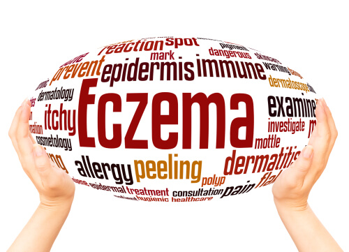 Eczema